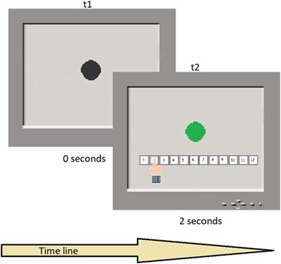 The Perception of Time Is Underestimated in Adolescents With Anorexia Nervosa